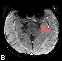 MRI-FAHNb-3